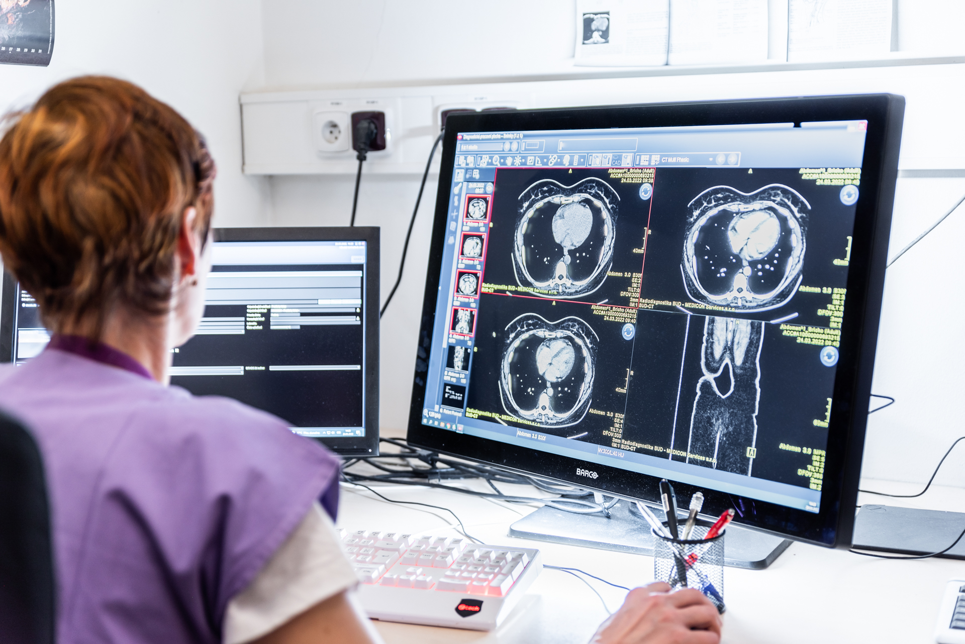 Modern CT scanner in the MEDICON RDG imaging centre